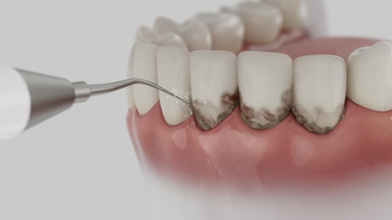 Reliable Dental Implants contractor in Montverde, FL by Smile Center Dentistry